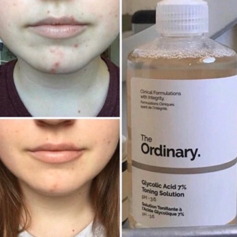 The Ordinary toner review