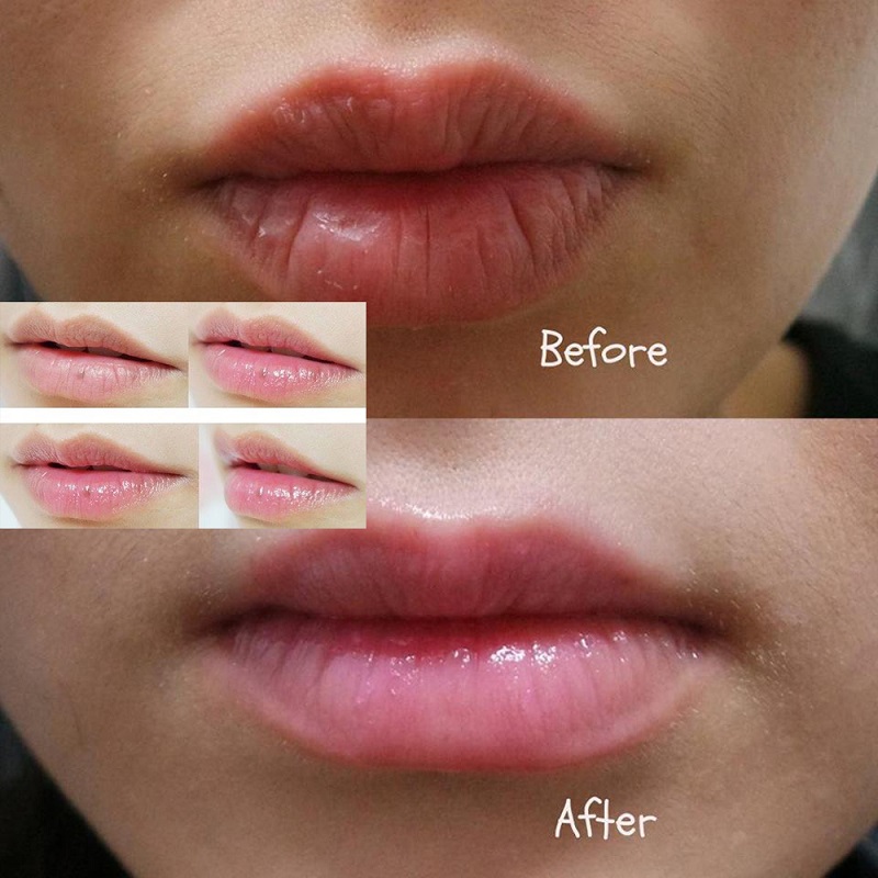 Dưỡng môi Vaseline Lip Therapy dạng thỏi review